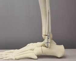 3d printed skeleton