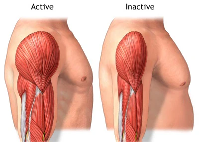 Muscle Loss